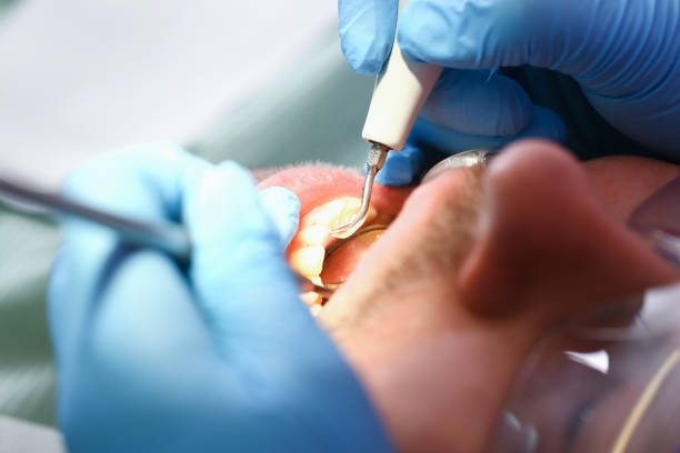 Best Walk-In Emergency Dentist in Labelle, FL