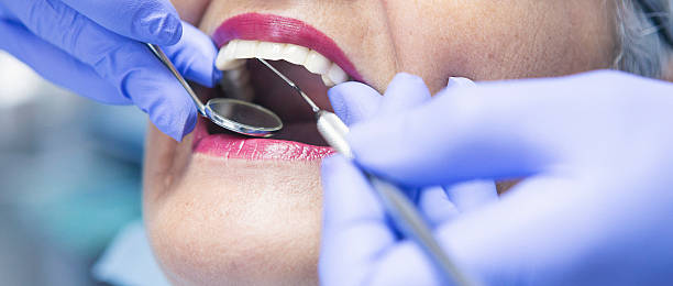 Best Emergency Broken Tooth Repair in Labelle, FL